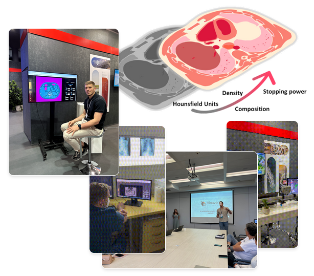 spectral CT tissue characterization