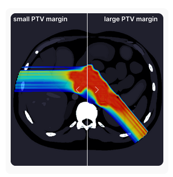 spectral CT tissue characterization