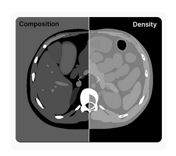spectral CT tissue characterization